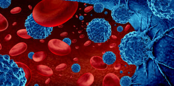 Cancer in the blood outbreak and treatment for malignant cells in a human body caused by carcinogens and genetics with a cancerous cell as an immunotherapy and leukemia or lymphoma symbol and medical therapy as a 3D render.