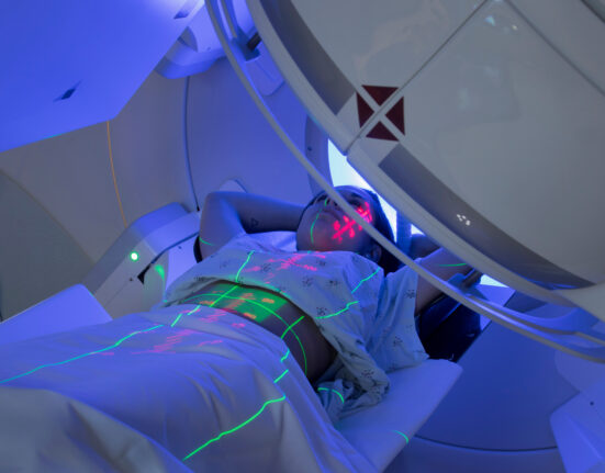 radiotherapy