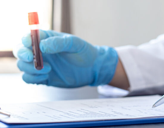 Scientists or physicians analyze the blood sample in vitro to prepare a vaccine against a new strain of viruses, Vaccine Research and Science concept.
