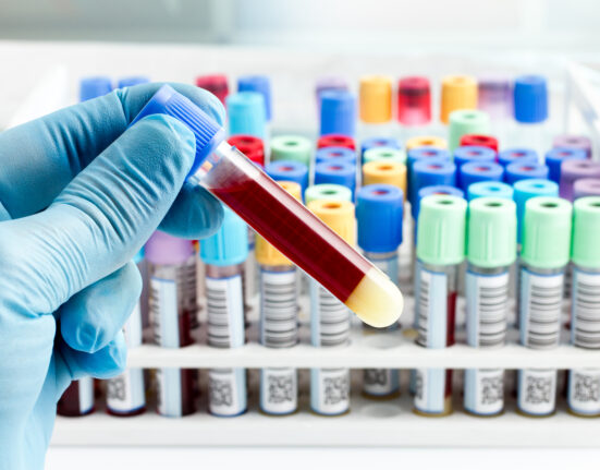 hand of a lab technician holding blood tube test and background a rack of color tubes with blood samples other patients / laboratory technician holding a blood tube test