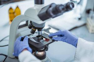 Smoldering Multiple Myeloma Incidence Trends