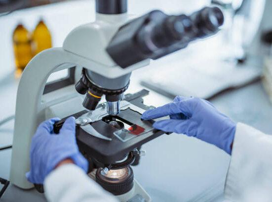 Smoldering Multiple Myeloma Incidence Trends